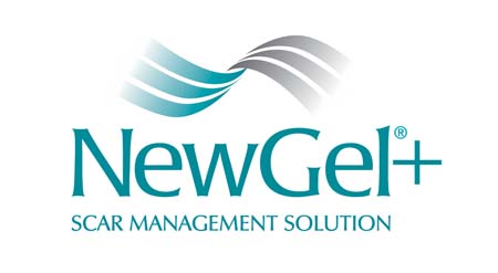 NewGel Scar Treatment